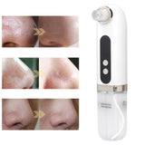 Face Vacuum Pore Cleaner Blue LED Oxygen Injector White Heads Removal Vacuum Hydration 6 Suction Heads 3 Modes for Facial Care