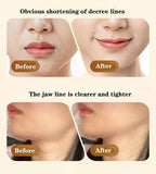 2023 Radio Frequency Skin Tightening Beauty Machine Face Lifting Skin Care Wrinkle Removal Dark Circles RF Facial Lifting Device