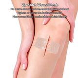 Zip Patch Easy Adjustment Stretch Bandage Non Woven Fabric Emergency Wound Closure Tape for Home Outdoor Office