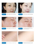 Japanese Magic Oxygen Bubble Machine Beauty Instrument Facial Cleaning Pore Removal Mite Removal Skin Management Beauty Salon