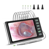 Digital Otoscope with 7-Inch Screen, Camera, Visual Ear Scoop Supports Photo Snapshots and Video Recording,