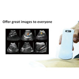192 elements wireless ultrasound probe scanner ear or convex Portable Blue tooth wifi-scanner USG pocket