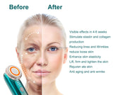 Home ems usb charging facial eye wrinkle removal lifting device Beauty massager personal facial skin care firming