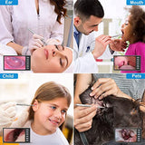 Digital Otoscope with 7-Inch Screen, Camera, Visual Ear Scoop Supports Photo Snapshots and Video Recording,