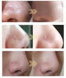 3 in 1 Aquasure H2 O2 Water Bubble Aqua deep cleaning Facial Spa Oxygen Peeling Dermabrasion Cleaning hine