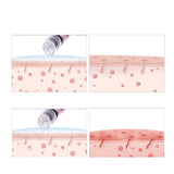 Small Bubbles Vacuum Suction Beauty Equipment Facial Blackhead Clean Skin Rejuvenation Improve Skin Color Oxygen