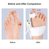 Bunion Unisex Foot Hal Valgus Braces Rotatable Separator Straightener Adjustable Pedicure Finger Toe Corrector