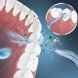 Electric Irrigator Portable Teeth Home Tooth Cleaning Oral Rinse Device To Remove Interdental Stain