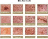 HD 200X 7 inches LCD Facial Analyzer Hair Analyser hine Digital Dermoscopy Analysis Detector Skin Care Tool