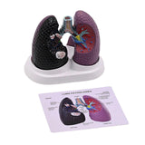 Realistic Lung Anatomy Model Anatomical Human Lung Model Teaching Tool Normal and Pathological Lung Anatomy Model