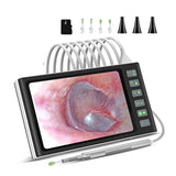 Digital Otoscope with 7-Inch Screen, Camera, Visual Ear Scoop Supports Photo Snapshots and Video Recording (32G)