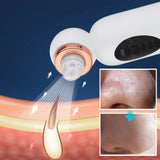 Blackhead Suction Water Circulation Cleaning Instrument Skin Oxygen Injection Pore Cleaner Small Bubbles