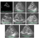 5.6 Inch LCD Screen Portable Veterinary Ultrasound Scanner Cattle Cow Pig Sheep Horse Farm Ultrasound Pregnancy Testing Machine