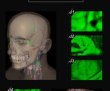 HD 2 megapixels Adjustable Adult Children Viewer Display Infrare Lights USB Camera Imaging IV Medical Vein Finder