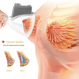 Vacuum Therapy Massager for Breast Augmentation and Butt Enlarger Enhancement