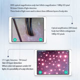Professional Device - WIFI Facial Scalp/Hair Follicle Detection Test Analysis. UV Human Skin Analyzer 50X/200X