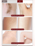 Women's Electric 4in1 Four Whole Body Epilator Usb Rechargeable Private Parts Shaver