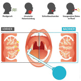 Manual PVC Ball Bad Breath Removal Throat Suction Tube Mouth Cleaner Tonsil Stone Vacuum Tool