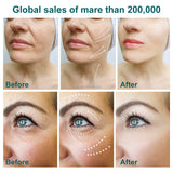 Home ems usb charging facial eye wrinkle removal lifting device Beauty massager personal facial skin care firming