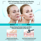 Microcurrent Facial Device RF Radio Frequency Eye Skin Tighten & Anti Aging Machine Reduces Wrinkles Face Lifting Eyes Massager