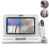 Professional 11 Inch Detector Scalp Hair Follicle Moisture Pores Magnifying Analyzer Skin Pigment Tester