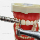 G Adjustable Lab Retractor Shield Protector Implants Gingival Retractions Tool Socket Gum Separator Isolation Replaced Tip