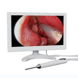 10 Inch HD Screen ENT Endoscope 3.9mm Camera Otoscope for Ear Nose Throat Inspection With Rechargeable Battery