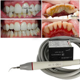 Lab Built in Ultrasonic Scaler N2 N2LED Fit E=S W--dpecker HW-3H HW-5L Scaling Handpiece Tips Teeths Whitenings Dentistrys Tools