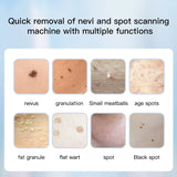 Portable Tattoo Removal Machines Wireless Tattoos Remove Equipment Women Skin Tag Remove Machine Blotches Dent Removal Device