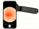IBOOLO DE-4100 Medical Dermatoscope 10X Magnification Polarized Light Compatible with Phone