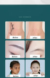 Eyebrow Washing Machine 1064nm Removing frecklesand washing tattoos and its dark pigment Black-faced doll Oil controlwhitening