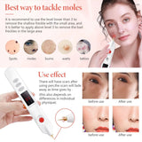 Beauty Electric Plasma Pen Removal Blackhead Dark Spot Pigment Anti Mole Tattoo Facial Wart Dark Spot Home Skin Care Tool