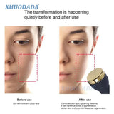 3 In 1 Ultrasonic Facial Machine Spot Removal Anti Aging Facial Slimming Massager Micro Plasma Freckle Removal Pen Beauty Device