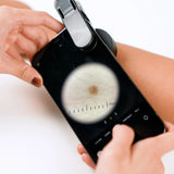 Dermatology DE-300 6X Skin Magnifier Dermoscopy Dermatoscope Dermascope