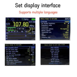High Sensitivity Desktop TEF6686 Radio Digital FM/AM Radio Built-in Lithium Battery And AM Antenna