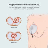 Pectus Excavatum Orthosis Excavatum Orthosis Brace,Pectus Excavatum Brace for Adults and Child,Depression Brace Sunken Sternum