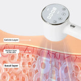 308nm Vitiligo Psoriasis Skin Treatment Lamp UVB Ultraviolet Phototherapy Instrument Skin Treatment Anti Vitiligo Psoriasis