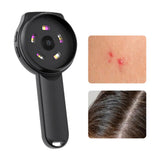 Digital Dermatoscope Scalp Analyzer Microscope with Light Handheld 2.8 inch Color Screen,Portable Digital Magnifying Glass 500x