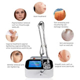 Portable CO2 Fractional Skin Resurface Acne Strech Mark Removal Scar Remove Beauty Device for Beauty Salon or Clinic Use
