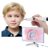 10 Inch HD Screen ENT Endoscope 3.9mm Camera Otoscope for Ear Nose Throat Inspection With Rechargeable Battery