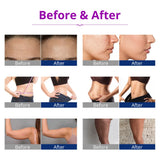 New 6 in1 40K RF Cavitation Machine Vacuum Slimming Machine Face Lifting Skin Rejuvenation Pore Cellulite Removal Equipment