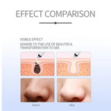 Electric Blackhead Remover Facial Pore Cleaner Machine Deep Cleaning Vacuum Extraction for Blackheads