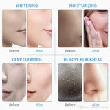6 in 1 Multifunction Water Facial Spa Cleaning Peeling Oxygen Skin Tightening Microdermabrasion Hydra Machine