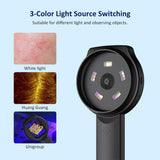 Digital Dermatoscope Scalp Analyzer Microscope with Light Handheld 2.8 inch Color Screen,Portable Digital Magnifying Glass 500x