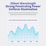 308nm Vitiligo Psoriasis Skin Treatment Lamp UVB Ultraviolet Phototherapy Instrument Skin Treatment Anti Vitiligo Psoriasis