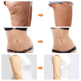 Sport Fat Burner Body Liposuction Machine Belly Arm Leg Fat Burning Body Shaping Slimming Massage Fitness Reducer Fat Devices