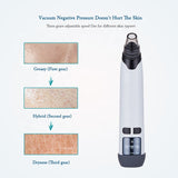 Multifunctional New Pore Cleaner Black Beauty Instrument Head Suction Extractor Kit Acne Removal Vacuum Blackhead Remover Tool