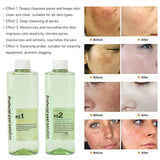 4pcs Hydra Peeg Facial for hine Deep Cleansing Hydro Dermabrasion Solution Serum