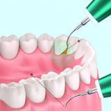 Electric Whitening Ultrasonic Tooth Cleaning Device Removal Dental Calculus hine Household