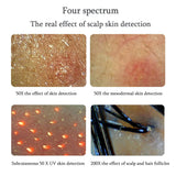 Professional 11 Inch Detector Scalp Hair Follicle Moisture Pores Magnifying Analyzer Skin Pigment Tester
